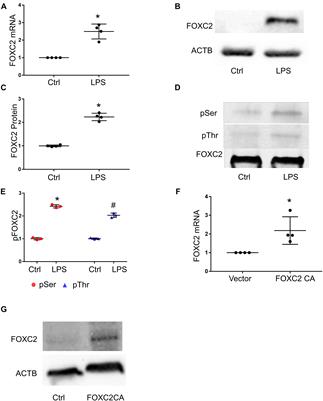 Frontiers | FOXC2 Autoregulates Its Expression in the Pulmonary ...