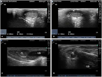 Frontiers Repeated Evaluations Of Testes And Semen Characteristics In Two Binturongs Arctictis Binturong Veterinary Science