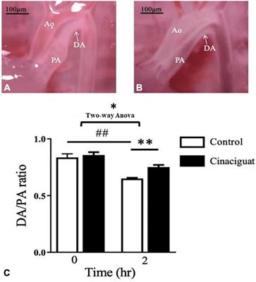 Frontiers Cinaciguat Prevents Postnatal Closure Of Ductus Arteriosus By Vasodilation And Anti Remodeling In Neonatal Rats Physiology