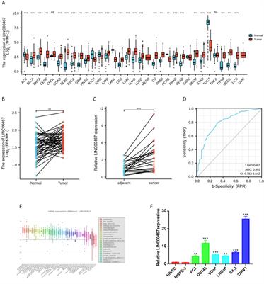 Frontiers | LINC00467 Promotes Prostate Cancer Progression via M2 ...