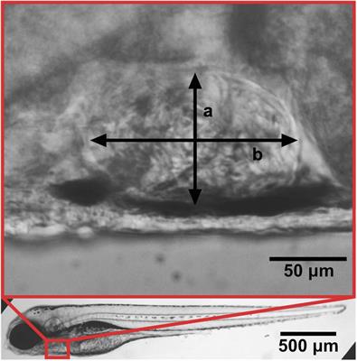 Frontiers Zebrafish Heart Failure Models