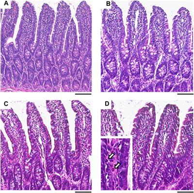 Frontiers | The Nonsteroidal Anti-Inflammatory Drug Ketorolac Alters ...