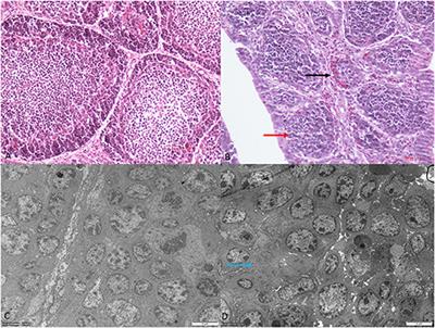 Frontiers | Tandem Mass Tag-Based Quantitative Proteomic Analysis of ...