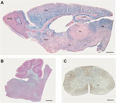 Frontiers | Elovl5 Expression in the Central Nervous System of the ...