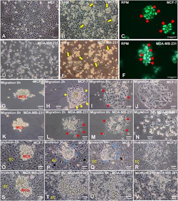 Morphology of breast cancer 3D cellular aggregates generated by