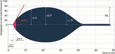 Frontiers | Hypocoagulable Tendency on Thromboelastometry Associated ...