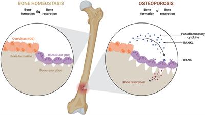 Frontiers  Immunoporosis: Role of Innate Immune Cells in Osteoporosis