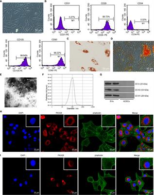 Frontiers | An In Vitro Study on Extracellular Vesicles From Adipose ...