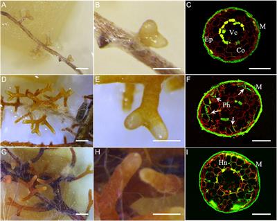 Frontiers Transcriptome Profiling Reveals Differential Gene Expression Of Secreted Proteases And Highly Specific Gene Repertoires Involved In Lactarius Pinus Symbioses Plant Science