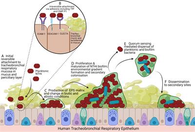 Frontiers | The Role of Non-Typeable Haemophilus influenzae Biofilms in ...