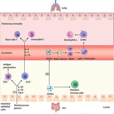 Frontiers | The Role of Gut Microbiota in Lung Cancer: From ...