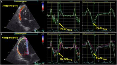 Frontiers  Myocardial strain analysis of echocardiography based