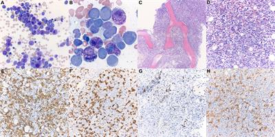 Frontiers | Comprehensive Clinicopathologic and Molecular Analysis of ...