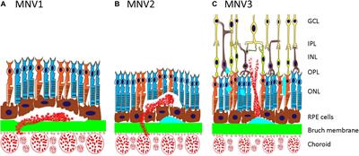 Frontiers | Clinical Pathological Features and Current Animal Models of ...