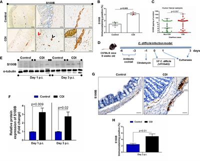 Frontiers S100b Inhibition Attenuates Intestinal Damage And Diarrhea Severity During Clostridioides Difficile Infection By Modulating Inflammatory Response Cellular And Infection Microbiology