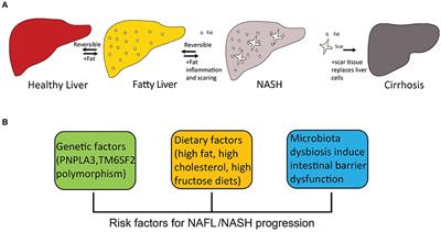 Frontiers | Non-alcoholic Steatohepatitis Pathogenesis, Diagnosis, and ...