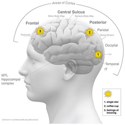 Know your brain: Prefrontal cortex