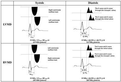 Frontiers | A Comparative Study of Systolic and Diastolic Mechanical ...