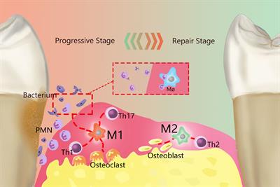 Frontiers | Polarized Macrophages in Periodontitis: Characteristics ...