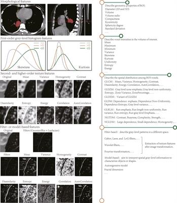 PDF) Advancements in MRI-Based Radiomics and Artificial Intelligence for  Prostate Cancer: A Comprehensive Review and Future Prospects