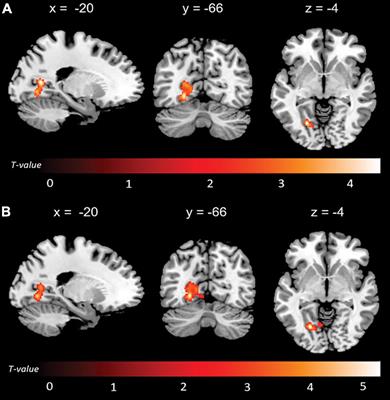 Frontiers | Altered Interplay Among Large-Scale Brain Functional ...