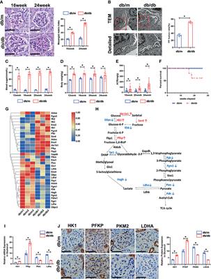 Frontiers | PFKP Activation Ameliorates Foot Process Fusion in ...