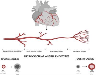 Mechanisms of Myocardial Ischemia in Cancer Patients: A State-of-the-Art  Review of Obstructive Versus Non-Obstructive Causes