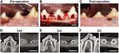 Frontiers  Adhesion of Teeth