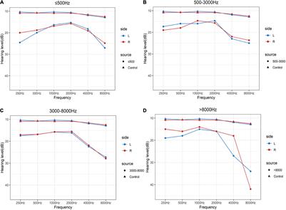 Tinnitus and normal hearing: a study on the transient otoacoustic