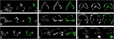 CT Segmentation of Dinosaur Fossils by Deep Learning - Image