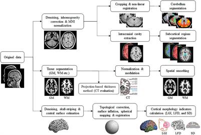 Motor Parkinson's disease and structure (Chapter 3) - Magnetic Resonance  Imaging in Movement Disorders