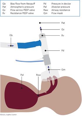 Frontiers  The Effect of a Higher Bias Gas Flow on Imposed T-Piece  Resistance and Breathing in Preterm Infants at Birth