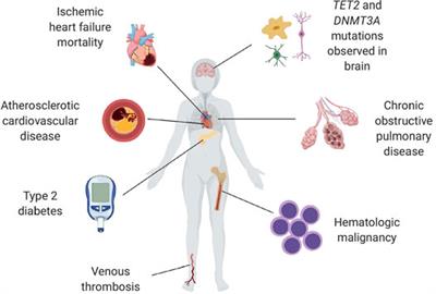 Distinction of lymphoid and myeloid clonal hematopoiesis