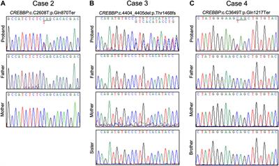 Rubinstein-Taybi 2 associated to novel EP300 mutations: deepening the  clinical and genetic spectrum, BMC Medical Genetics