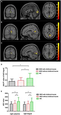 Frontiers  Neural activity in adults with major depressive disorder  differs from that in healthy individuals: A resting-state functional  magnetic resonance imaging study