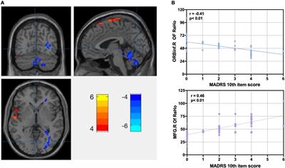 Frontiers | Identifying Changes of Brain Regional Homogeneity and ...