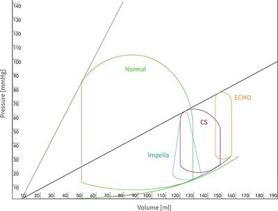 Left Ventricular Pressure-Volume Work Loop With Mechanical Circulatory  Support