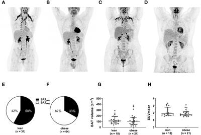 Associations of brown adipose tissue (BAT) 18 F-FDG activity after a