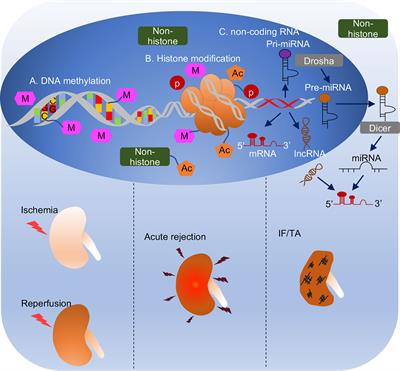 Frontiers | Epigenetic Regulation in Kidney Transplantation