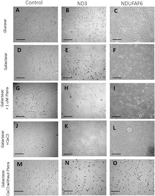 Pterostilbene In Combination With Mitochondrial Cofactors Improve Mitochondrial Function In Cellular Models Of Mitochondrial Diseases Frontiers