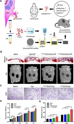 Frontiers | Exosome-Laden Hydrogels: A Novel Cell-free Strategy for In ...