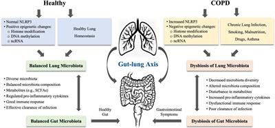 Frontiers | COPD and Gut–Lung Axis: How Microbiota and Host ...