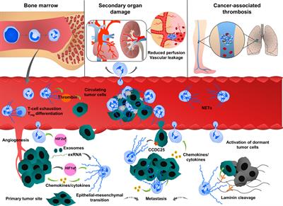Frontiers  The implication of neutrophil extracellular traps in  nonalcoholic fatty liver disease