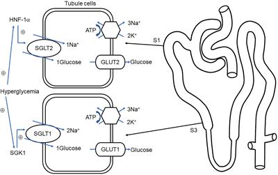 Frontiers | Update on Pathogenesis of Glomerular Hyperfiltration in ...