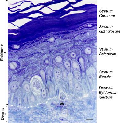 Solved The Dermis Extends Upward Between Ridges of