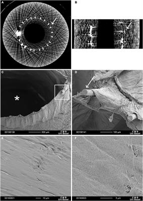 Frontiers | Small-diameter bacterial cellulose-based vascular grafts ...