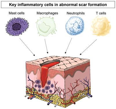 Frontiers | Controlling Inflammation Pre-Emptively or at the Time of ...