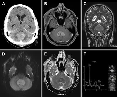 Frontiers | An Update on Neurosurgical Management of Primary CNS ...