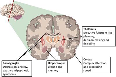 Brain Hypoxia Is Associated With Neuroglial Injury in Humans Post–Cardiac  Arrest