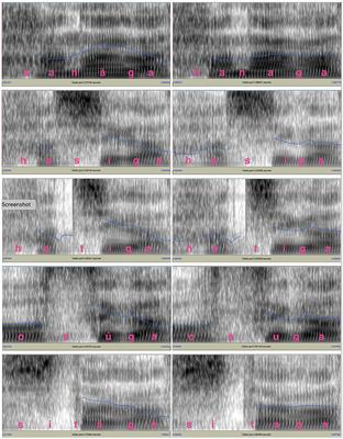 312px x 400px - Identification of Minimal Pairs of Japanese Pitch Accent in Noise-Vocoded  Speech - Frontiers